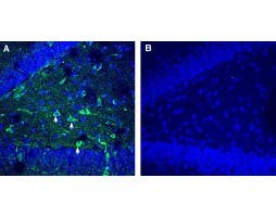 Anti-TMEM106B (extracellular) Antibody