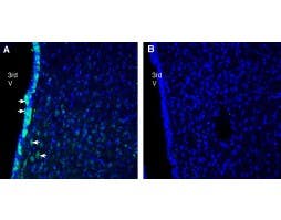 Anti-Progranulin Antibody