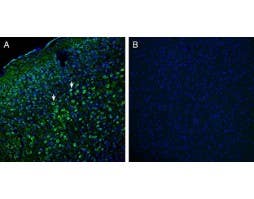 Anti-Robo1 (extracellular) Antibody