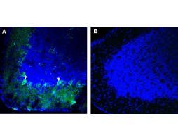 Anti-Robo3 (extracellular) Antibody