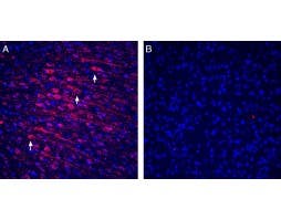Anti-Tetraspanin-3 (extracellular) Antibody
