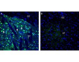 Anti-Neuronal Pentraxin 1 (NPTX1) Antibody