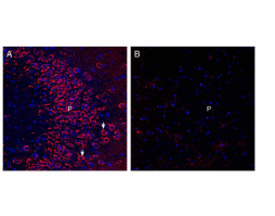Anti-Neuronal Pentraxin Receptor (NPTXR)(extracellular) Antibody