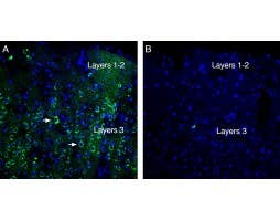 Anti-Neogenin (extracellular) Antibody