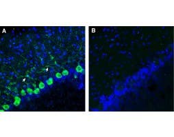 Anti-SLC36A1 (PAT1) Antibody