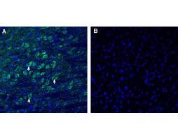 Anti-CADM1/SynCAM (extracellular) Antibody