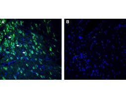 Anti-SEZ6 (extracellular) Antibody