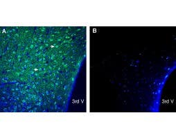 Anti-CD63 (extracellular) Antibody