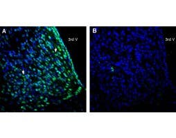 Anti-CD81 (extracellular) Antibody