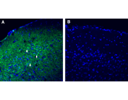 Anti-SPARC Antibody