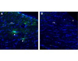Anti-TMEM108 (extracellular) Antibody