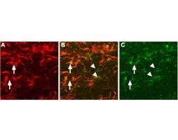 Anti-proNGF Antibody
