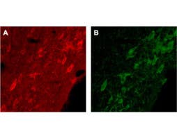 Anti-p75 NGF Receptor (extracellular) Antibody