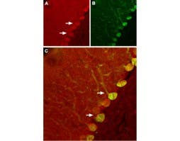 Anti-Nogo Receptor (extracellular) Antibody