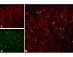 Anti-Sortilin (extracellular) Antibody
