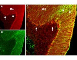 Anti-BDNF Antibody