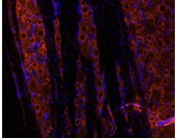 Anti-GDNF Antibody