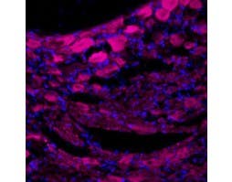 Anti-TrkA (extracellular)-ATTO Fluor-633 Antibody