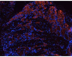 Anti-TrkB (extracellular) Antibody