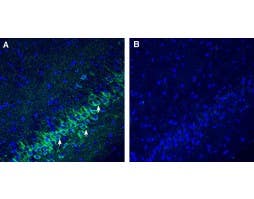 Anti-SLC25A22 (GC1) Antibody