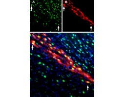 Anti-CDNF Antibody