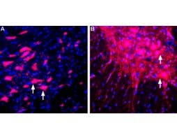 Anti-LINGO-1 (extracellular) Antibody