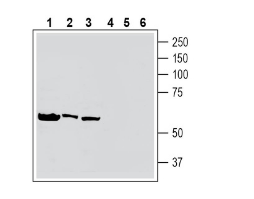 Anti-Human Tumor Necrosis Factor Receptor 2 (extracellular) Antibody
