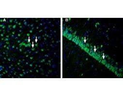 Anti-IGF1R (extracellular) Antibody