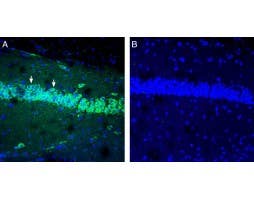 Anti-IGF1 Antibody