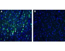 Anti-CART Antibody