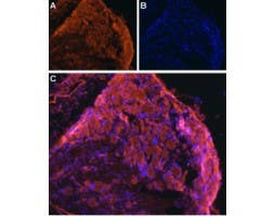 Anti-ENT1 (SLC29A1) Antibody