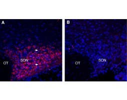 Anti-PMAT (SLC29A4) Antibody