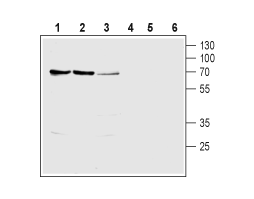Anti-SLC28A1 (CNT1) Antibody