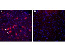 Anti-CD157/BST1 (extracellular) Antibody