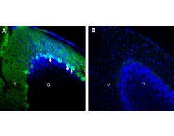 Anti-CD38 (extracellular) Antibody