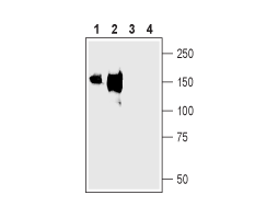 Anti-NKCC2 (SLC12A1) Antibody