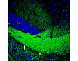 Anti-ASCT2 (SLC1A5) Antibody
