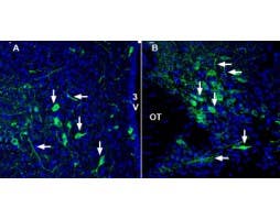 Anti-SLC17A9 Antibody