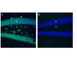 Anti-SLC7A2 (extracellular) Antibody