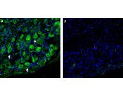 Anti-LAT1 (SLC7A5) Antibody