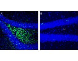 Anti-LAT2 (SLC7A8) (extracellular) Antibody