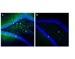 Anti-SLC25A12 Antibody