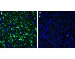 Anti-SLC47A1 Antibody
