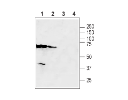 Anti-SLC47A2 Antibody
