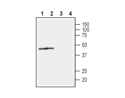 Anti-NIPA2 (extracellular) Antibody