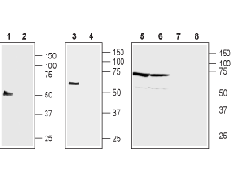 Anti-NIPAL4 (extracellular) Antibody