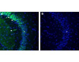 Anti-MRS2 Antibody