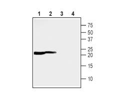 Anti-MMGT1 Antibody