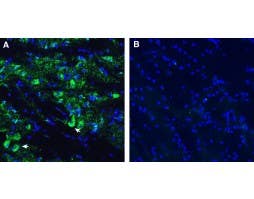 Anti-SLC10A4 (extracellular) Antibody