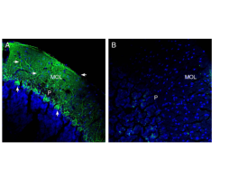 Anti-SLC38A1 Antibody